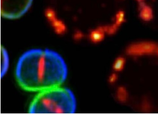 Bacterial Cell Division Uncovered.